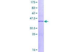Image no. 1 for Pre-B Lymphocyte 3 (VPREB3) (AA 1-123) protein (GST tag) (ABIN1325036)