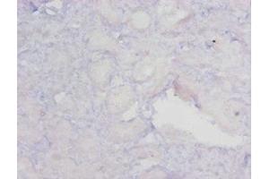 Immunohistochemistry of paraffin-embedded human kidney tissue using ABIN7159622 at dilution of 1:20 (MGMT anticorps  (AA 4-207))