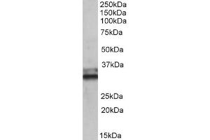 ABIN571194 (0. (ETFA anticorps  (AA 139-152))