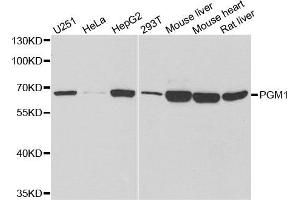 Western Blotting (WB) image for anti-Phosphoglucomutase 1 (PGM1) antibody (ABIN1980319) (Phosphoglucomutase 1 anticorps)