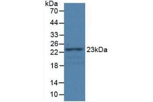 Western Blot; Sample: Recombinant FBLN1, Rat. (Fibulin 1 anticorps  (AA 347-521))