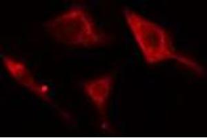 ABIN6278812 staining Hela cells by IF/ICC. (Adenylate Kinase 5 anticorps  (N-Term))