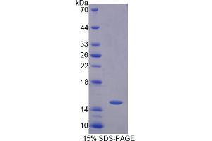 Image no. 1 for CREB Regulated Transcription Coactivator 3 (CRTC3) (AA 1-103) protein (His tag) (ABIN6237021)