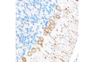 Immunohistochemistry of paraffin-embedded Mouse brain using MMP17 Rabbit pAb (ABIN3017219, ABIN3017220, ABIN3017221 and ABIN1680859) at dilution of 1:100 (40x lens).