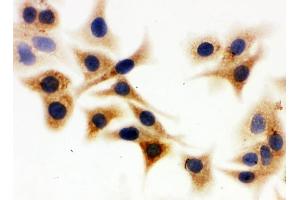 IHC analysis of IDH1 using anti-IDH1 antibody (ABIN3043855).