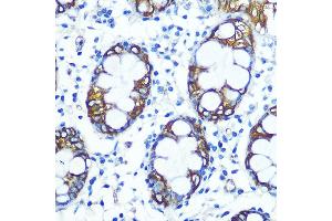 Immunohistochemistry of paraffin-embedded human colon using FUT4 Rabbit pAb (ABIN7267274) at dilution of 1:100 (40x lens).