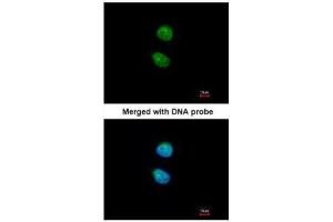 ICC/IF Image Immunofluorescence analysis of paraformaldehyde-fixed HeLa, using ZNF306 , antibody at 1:200 dilution.