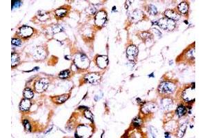 Image no. 2 for anti-Zinc Finger Protein 395 (ZNF395) (Center) antibody (ABIN357344) (ZNF395 anticorps  (Center))