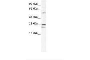 Image no. 1 for anti-Gap Junction Protein, beta 2, 26kDa (GJB2) (AA 85-134) antibody (ABIN202090) (GJB2 anticorps  (AA 85-134))