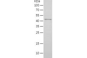 Western Blotting (WB) image for Melanoma Antigen Family B, 1 (MAGEB1) (AA 1-347) protein (His tag) (ABIN7123894)