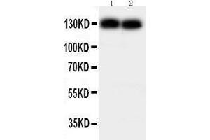 Anti-N Cadherin antibody, Western blotting Lane 1: MCF-7 Cell Lysate Lane 2: HELA Cell Lysate (N-Cadherin anticorps  (Middle Region))