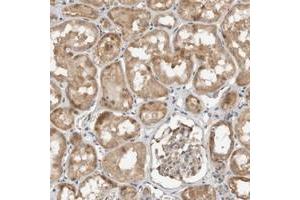 Immunohistochemical staining of human kidney with GINS4 polyclonal antibody  shows moderate cytopolasmic positivity in tubular cells.