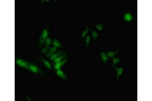 Immunofluorescent analysis of Hela cells using ABIN7155138 at dilution of 1:100 and Alexa Fluor 488-congugated AffiniPure Goat Anti-Rabbit IgG(H+L)