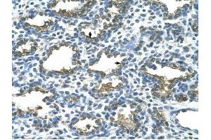 ALPP antibody was used for immunohistochemistry at a concentration of 4-8 ug/ml to stain Alveolar cells (arrows) in Human Lung. (PLAP anticorps)