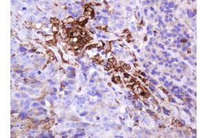 Image no. 2 for anti-Mucin 1 (MUC1) antibody (ABIN1499598)