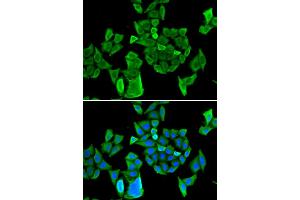Immunofluorescence analysis of HeLa cells using CCAR1 antibody (ABIN6291285). (CCAR1 anticorps)