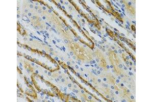 Immunohistochemistry of paraffin-embedded Mouse kidney using COG2 Polyclonal Antibody at dilution of 1:100 (40x lens). (COG2 anticorps)