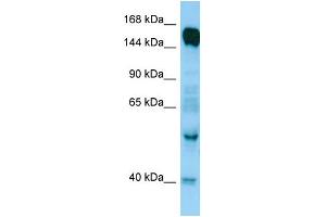 WB Suggested Anti-RAPGEF6 Antibody Titration: 1.