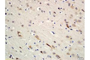 Formalin-fixed and paraffin embedded rat brain tissue labeled with Rabbit Anti-Erbin Polyclonal Antibody, Unconjugated (ABIN2173874) at 1:200 followed by conjugation to the secondary antibody and DAB staining (ERBB2IP anticorps  (AA 21-120))