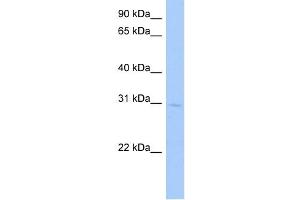 GSTA5 antibody used at 0. (GSTa5 anticorps  (Middle Region))