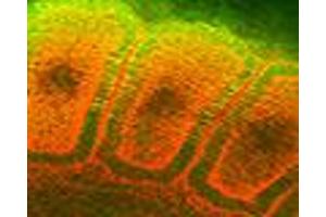 Hsp25 Hsp27 (8A7), somites of a rat embryo  Courtesy of Mike Welsh, UMich .