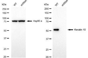 Western blotting analysis using Keratin 10 antibody (ABIN7799163).