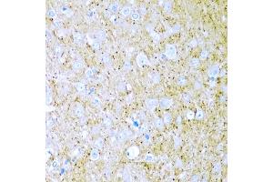 Immunohistochemistry of paraffin-embedded rat brain using WNT2 antibody (ABIN6130801, ABIN6150239, ABIN6150241 and ABIN6221571) at dilution of 1:200 (40x lens). (WNT2 anticorps  (AA 26-360))