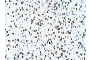HNRPA1 antibody was used for immunohistochemistry at a concentration of 4-8 ug/ml to stain Myocardial cells (arrows) in Human Head. (HNRNPA1 anticorps  (N-Term))