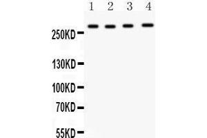 Anti-Mannose 6 Phosphate Receptor(Cation independent) antibody, Western blotting All lanes: Anti Mannose 6 Phosphate Receptor (Cation independent)  at 0.