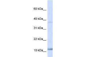 WB Suggested Anti-NHLH1 Antibody Titration:  0. (NHLH1 anticorps  (N-Term))