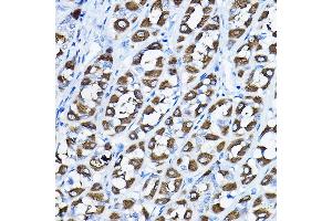 Immunohistochemistry of paraffin-embedded rat stomach using PGLS Rabbit pAb (ABIN6131432, ABIN6145509, ABIN6145510 and ABIN6224398) at dilution of 1:200 (40x lens). (PGLS anticorps  (AA 1-258))