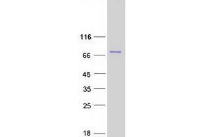 Validation with Western Blot