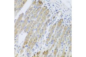 Immunohistochemistry of paraffin-embedded mouse stomach using RARS2 antibody at dilution of 1:100 (x40 lens).
