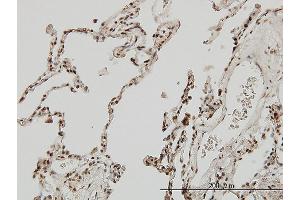 anti-Myocyte Enhancer Factor 2A (MEF2A) (AA 71-170) antibody