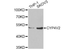Western blot analysis of extracts of various cell lines, using CYP4V2 Antibody (ABIN2562110) at 1:1000 dilution. (CYP4V2 anticorps)