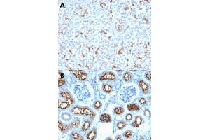 Immunohistochemical staining (Formalin-fixed paraffin-embedded sections) of human pancreas (A) and mouse kidney (B) with CFTR monoclonal antibody, clone CFTR/1342 . (CFTR anticorps)