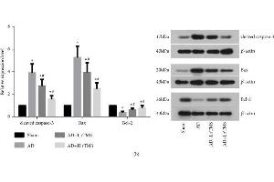 Effect of rTMS on apoptosis and viability of neurons in hippocampus regions of AD mice.