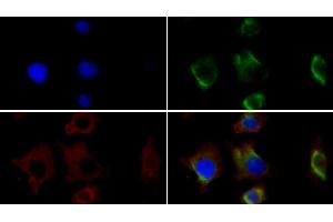 Detection of VIM in Human HepG2 cell using Monoclonal Antibody to Vimentin (VIM) (Vimentin anticorps)
