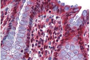 anti-RNA Binding Motif Protein 47 (RBM47) (AA 287-336) antibody