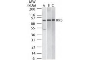 IKKb IKK2 Western Blot.