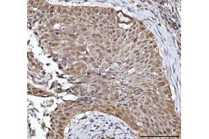 IHC analysis of 14-3-3 gamma/YWHAG using anti-14-3-3 gamma/YWHAG antibody (ABIN7600596). (14-3-3 gamma anticorps  (AA 21-162))