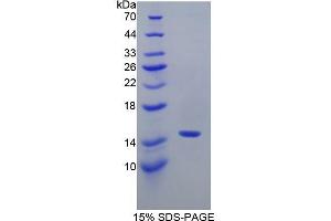 SDS-PAGE (SDS) image for Neurofilament, Light Polypeptide (NEFL) (AA 281-396) protein (His tag) (ABIN1171000)