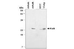 Image no. 1 for anti-V-Ral Simian Leukemia Viral Oncogene Homolog B (Ras Related, GTP Binding Protein) (Ralb) antibody (ABIN204644)