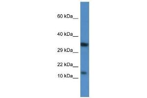 Western Blot showing Pkib antibody used at a concentration of 1. (PKIB anticorps  (Middle Region))