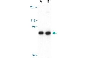 Western blot analysis of CDH13 in NIH/3T3 lysate with CDH13 polyclonal antibody  at (A) 0. (Cadherin 13 anticorps  (N-Term))