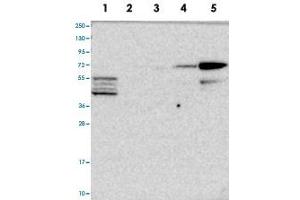 Western blot analysis of Lane 1: RT-4, Lane 2: U-251 MG, Lane 3: Human Plasma, Lane 4: Liver, Lane 5: Tonsil with CLIP4 polyclonal antibody  at 1:100-1:250 dilution.