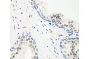 Immunohistochemistry of paraffin-embedded Human prostate using PPAN Polyclonal Antibody at dilution of 1:200 (40x lens). (PPAN anticorps)
