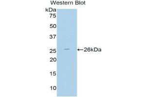 Western Blotting (WB) image for anti-Thyroid Peroxidase (TPO) (AA 19-846) antibody (ABIN1860847) (Thyroperoxidase anticorps  (AA 19-846))