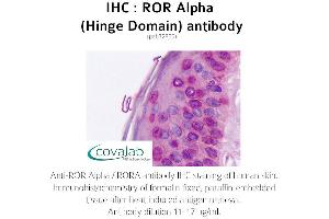Image no. 2 for anti-RAR-Related Orphan Receptor A (RORA) antibody (ABIN1738922) (RORA anticorps)