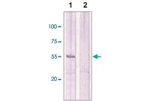 The whole cell lysates derived from MCF-7 were immunoblotted by ESR2 polyclonal antibody  at 1 : 500 (Lane 1). (ESR2 anticorps  (C-Term))